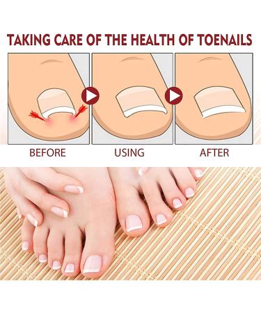 Lot de 2 huiles allemandes anti-paronychia pour ongles des pieds et des orteils endommag s et d color s - Buy Online on GoSupps.com