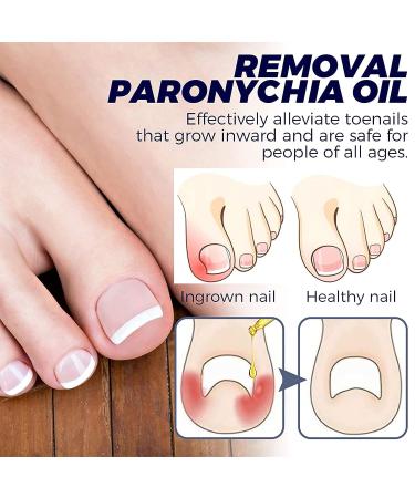 German Toenailplus & NailPro Anti Paronychia Relief Oil - Set of 2Pcs / 3Pcs - Buy Online on GoSupps.com