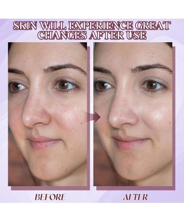 Algensalbe AKTIV Algensalbe Pommade aux algues Pommade active aux algues contre les t langiectasies Pommade aux algues pour les jambes pour les t langiectasies Vainqueur du test de la cr me(1PC) Rose - Buy Online on GoSupps.com