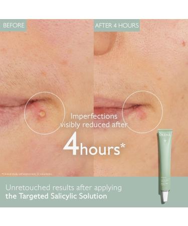 Caudalie Vinopure Color Correcting Spot Solution - Salicylic Acid for Acne & Blemish Control | Shop Worldwide - Buy Online on GoSupps.com