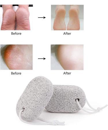 PHOGARY Natural Pumice Stone for Feet 3 PCS - Lava Pedicure Tools for Callus Removal on Feet and Hands - Exfoliating Foot File for Dead Skin Removal - Buy Online on GoSupps.com