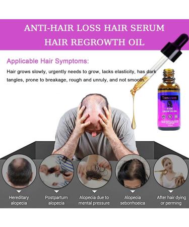 Trendyfave Hair Growth Serum Vitamins Serum for Hair Loss and Hair Regrowth Ginger Oil for Hair Growth for Balding Thinning Repairs Hair Follicles Natural Herbal Hair Growth Oils for Men and Women - Buy Online on GoSupps.com