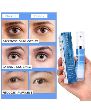 5% Caffeine Eye Serum & Cream | Anti-Aging Under Eye Roller for Wrinkles & Dark Circles - Buy Online on GoSupps.com