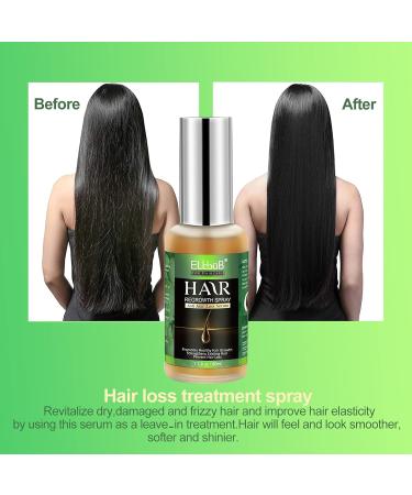 Hair Growth Serum - Thicker & Healthier Hair Oil with Biotin | Reduces Shedding Globally - Buy Online on GoSupps.com