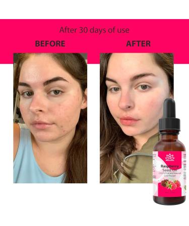 Relaxcation Pure Raspberry Seed Oil - Cold Pressed & Unrefined Natural Oil from USA | Lightweight Berry Extract for Smooth Skin Healthy Glow & Daily Botanical Blends (2 oz) 2 Fl Oz (Pack of 1) - Buy Online on GoSupps.com