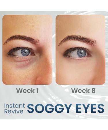 AEEHFENG Dobshow DERMA+ Firm Peptide Firming Eye Gel Open Eyes Awaken Peptide Lifting Eye Gel Natural Lifts Firming Eye Serum for Remove Eye Bags Dark Circles & Eye Wrinkles (1 Pack) - Buy Online on GoSupps.com