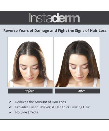 Hair Stimulating Growth Serum - Extra Strength DHT Blocker for Thicker Fuller Hair | Follicle Restoration for Men & Women - Shop Now - Buy Online on GoSupps.com