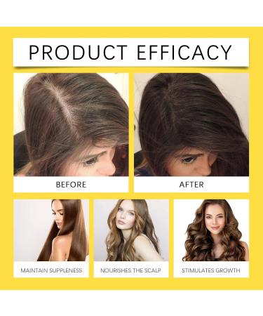 Shantou Youjia 2pcs Ginger Hair Growth Oil Ginger Hair Growth Oil Ginger Essential Hair Oil AntiHair Loss Ginger Serum Hair Restoration Ginger Serum Hair Loss and Hair Thinning Treatment - Buy Online on GoSupps.com