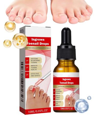 Nail and Toenail Strengthening Liquid 10ml Ingrown Toenail Corrector Drops - Beauty Care for Hands and Feet - Night Travel Treatment for Dry Damaged Cracked Curved Fragile and Peeling Nails - Buy Online on GoSupps.com
