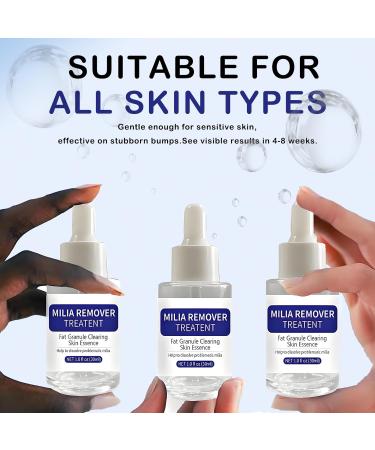 Dermfree Milia Remover Treatment Milia Spot Treatment with Salicylic Acid Milia Acne Serum Clearing Skin Essence(30ML) - Buy Online on GoSupps.com