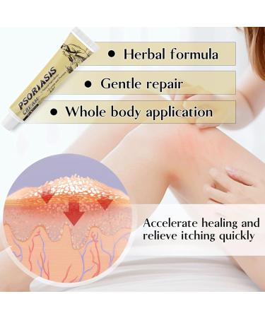 Buy Psoriasis & Eczema Creams | Natural Herbal Moisture Creams & Anti-Itching Solutions - Buy Online on GoSupps.com
