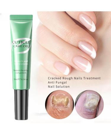 Nail & Cuticle Oil Pen Cuticle Oil Pen for Nail Care Hydrating Moisturising Cuticle Oil Nail Nutrition Pen Nail Growth Treatment Repair Treatment for Damaged Nails Nourish Dry Nails and Cuticles - Buy Online on GoSupps.com