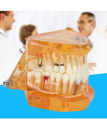 Dpofirs Orange Dental Model - Removable Teaching Tool for Dental Programs Adult Tooth Demonstration & Dental Implants - Buy Online on GoSupps.com