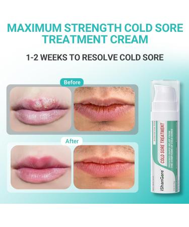 ishancare Cold Sore Treatment Cream Fast Relief Soothing Moisture Portable & Hypoallergenic Formula for Healthy Lips 0.36oz(10g) - Buy Online on GoSupps.com