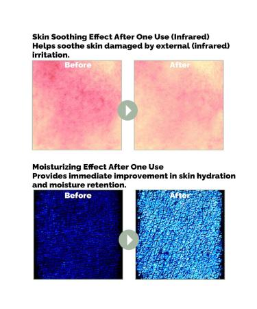 PRETTYSKIN Cica Exosome Soothing Cream with 75% Centella Asiatica Extract, Vitamin K Complex, and Hyaluronic Acid Gentle Hydration for Sensitive Skin (2.02 fl.oz / 60ml) - Buy Online on GoSupps.com