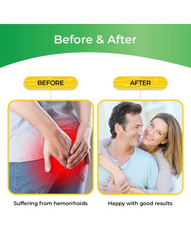 Hemorrhoid Treatment Wipes with Witch Hazel | 30 Count for Maximum Relief from Pain, Burning, and Itching - Buy Online on GoSupps.com