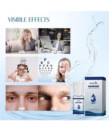 13ml Eye Care Drops Relieve Red Eye Dry Eye Blurred Vision Eye Fatigue Eye - Buy Online on GoSupps.com