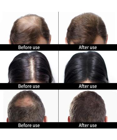 Hair Building Fibers Hair Densifiers with Applicator for Concealing Baldness for Men and Women (Black) - Buy Online on GoSupps.com