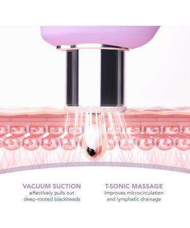 FOREO Kiwi Derma Microdermabrasion Machine - Whitehead & Blackhead Remover Tool - Buy Online on GoSupps.com