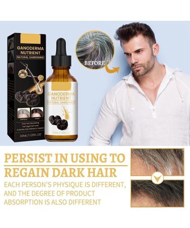 S rum Anti-Cheveux Gris Anti-Greying Hair Serums S rum Pour Cheveux Gris Huile Capillaire R paratrice Serum Cheveux Natural Hair Darkening Serum Natural Ganoderma Hair Oil (3) - Buy Online on GoSupps.com