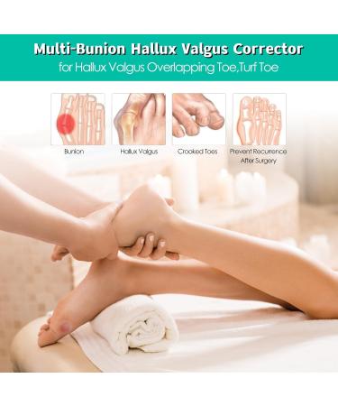 Kireina Bunion Relief Corrector - Nighttime Toe Separator for Hallux Valgus Overlapping Toes & Turf Toe Pain Relief - Buy Online on GoSupps.com