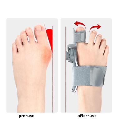 Upgraded Double Correction Bunion Corrector - 3-in-1 Adjustable Big Toe Relief Splint for Men & Women - Comfortable & Effective Hammer Toe Straightener - 6 Adjustable Settings (Black - Buy Online on GoSupps.com