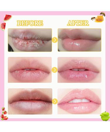 6 Pcs Bee Lip Balm Honey Pot-Honey Strawberries Watermelon Apples Cherries Mint Propolis Lip Mask Overnight Nourishing Hydrating Lip Balm Preventing Dry & Cracked Lips Reduce Lip Lines - Buy Online on GoSupps.com