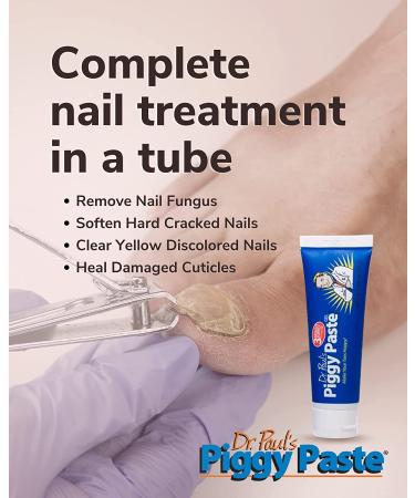 Piggy Paste Toe Nail Fungus Treatment by Dr. Paul - Restores Brittle Yellow Nails To Health - Buy Online on GoSupps.com