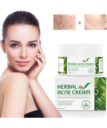 Beslibate herbal acne cream - 1.76 oz - Buy Online on GoSupps.com
