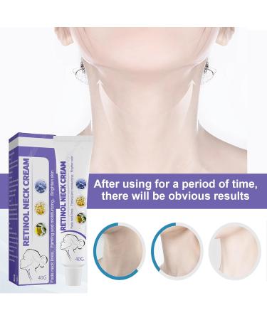 Neck Firming Anti Wrinkle Cream Skin Strengthen Tightening Cream Reduce Neckline Anti-Aging Lifting Sagging Moisturizer Repair Crepe Sagging for Neck - Buy Online on GoSupps.com