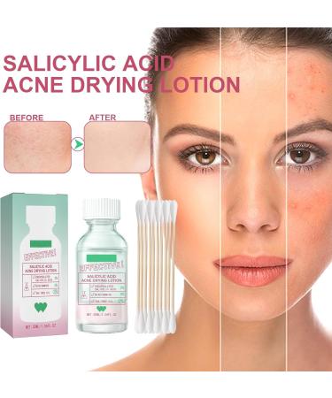 Nmbol Salicylic Acid Face Serum 3 - Buy Online on GoSupps.com