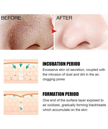 Blackhead Remover Pore Strips Blackhead Mask Blackhead Strips Blackhead Mask Blackhead Remover Mask Peel off Mask Facial Pore Cleanser Purifying Face Mask Nose Strips 30g - Buy Online on GoSupps.com