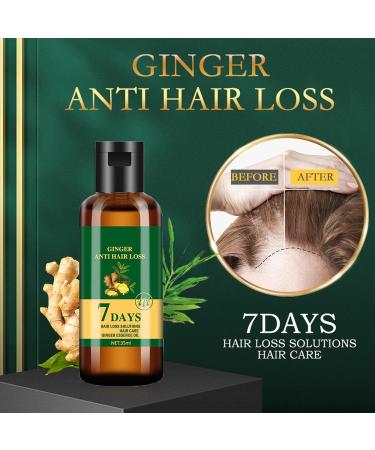  homomdy Lidoria 7 Day Ginger Hair Loss Oil Hair Growth Oil Anti Hair Loss Serum Natural Ginger Hair Growth Germ Serum (2PCS) - Buy Online on GoSupps.com