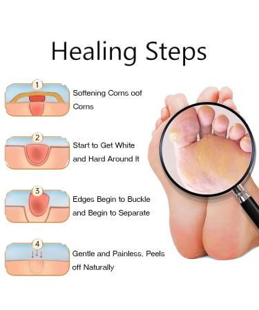 Maximum Strength Corn Removers for Feet & Toes - 12PCS - Buy Online on GoSupps.com