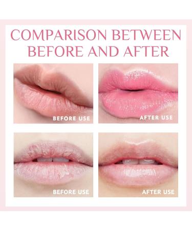 Lip Mask - Lip Sleeping Mask Overnight - Lip Care Lip Repair - Berry Lip Masks - Hydrating Lip Balm - Vitamin C Lip Scrub - Lip Moisturizer for Dry Lips - Fades Lip Lines - Buy Online on GoSupps.com