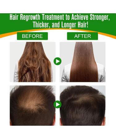 Dr. Sebi Batana Oil for Hair Growth - 100% Pure Organic Essential Oil (2.02Oz) | Prevent Hair Loss & Eliminate Split Ends for Men & Women - Buy Online on GoSupps.com