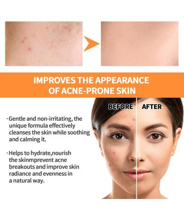 Blackhead Remover 135 Oz Cleanse Purifying Turmeric Clay Face Mud Masque Black Head Remover for Women Men Facial Care Products Qihuyi - Buy Online on GoSupps.com