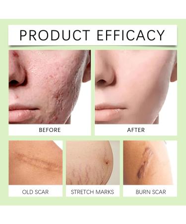 Nuvilo Centella Asiatica & Panthenol Gel for face and body reduces redness and pigmentation suitable for sensitive skin easytouse formula for smoother skin 1 piece 1 piece - Buy Online on GoSupps.com