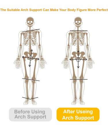 Foot Arch Supports Insoles for Plantar Fasciitis Relief - Ideal for Flat Feet & High Arches | Pain Relief for Heel Back Hip Leg Knee and Foot - Unisex Support Inserts - Buy Online on GoSupps.com