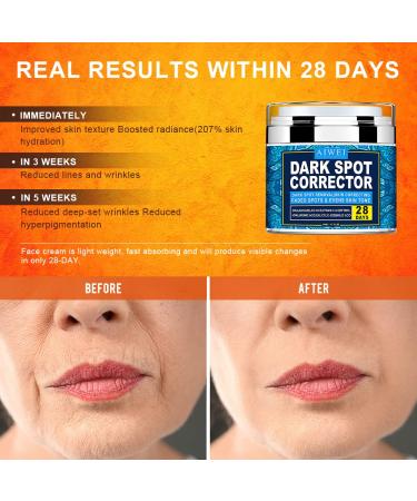 AIWEI Face and Body Moisturizer Cream with Advanced Ingredients | Retinol Cream for Men & Women - Buy Online on GoSupps.com