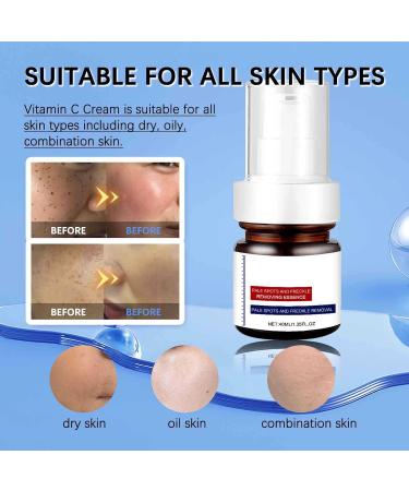 Whitening & Freckle Removing Essence - 30ml Vitamin C Spot Cream for Melasma Melanosis Acne Scars - Best Skin Brightening Serum - Buy Online on GoSupps.com