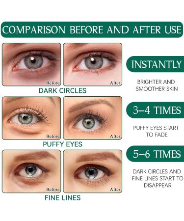 Collagen Eye Pads 60 PCs Hydrating Eye Masks for Dark Circles & Puffiness | Aloe Vera & Hyaluronic Acid Formula - Buy Online on GoSupps.com