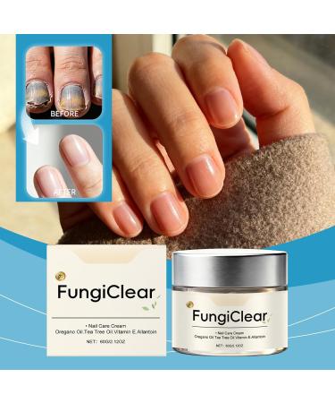 Cr me R paratrice et Fortifiante pour Ongles Ab m s Soin Intensif Ongles Durcisseur et Stimulant de Croissance R pare les Fissures Pr viens les Cassures Traitement Nourrissant Domicile - Buy Online on GoSupps.com