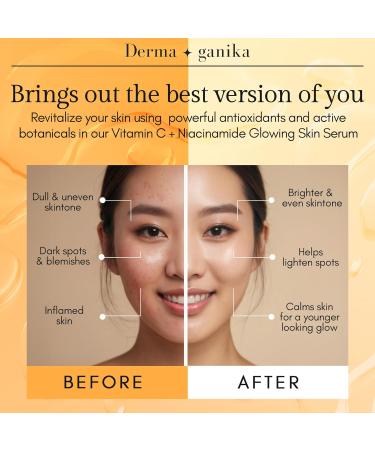 Derma ganika Vitamin C & Niacinamide Serum + Hyaluronic Acid Serum for Face & Neck - Buy Online on GoSupps.com