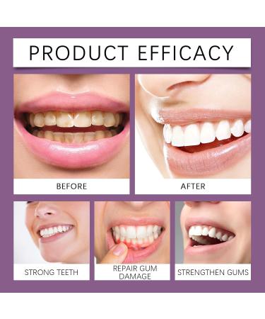  Cynamus Multi-Care - Fresh Mint Mouth Rinse - 120 ml - Daily Mouthwash - Cavity Protection - For Daily Maintenance and Cleaning - Fights Bad Breath - Buy Online on GoSupps.com