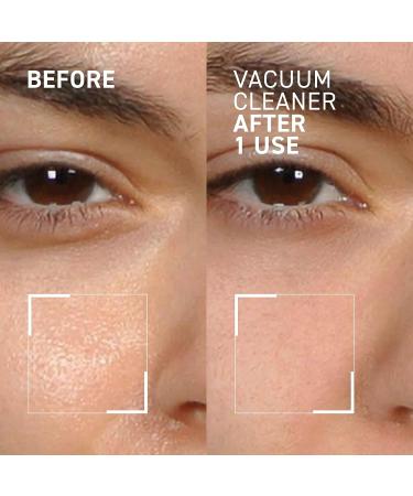 Dr. Brandt Pores No More Vacuum Cleaner Purifying Mask 1 Oz - Buy Online on GoSupps.com