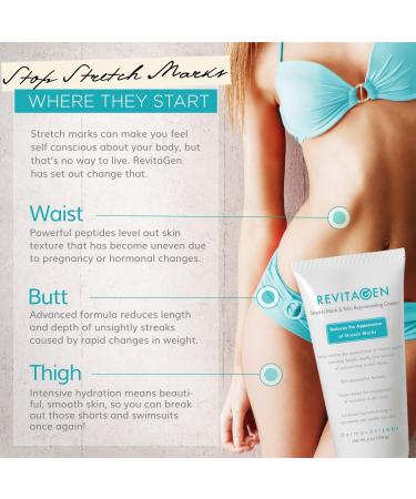 Revitagen-Fx Stretch Mark & Skin Repair Formula 6 Oz | Effective International Shipping - Buy Online on GoSupps.com