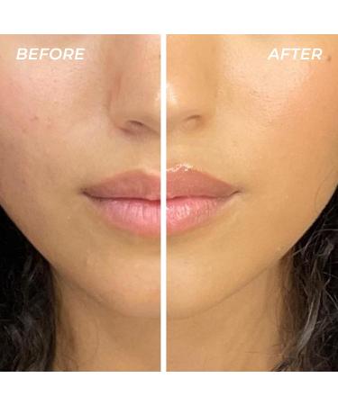 MCoBeauty - Mega Balm All-Over Ointment - Multi-Purpose Coconut-Scented Balm for Hydrating Lips Elbows and Cuticles - Conditioning Blend - Versatile Versatile Lip Balms & Moisturizers - Buy Online on GoSupps.com