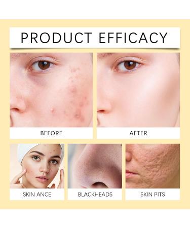 FFEEJ Gentle Honey Foam Cleanser Mild Cleansing Face Wash For Hydration Oil Control & Refreshing Skin - Buy Online on GoSupps.com