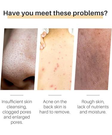  G n rique Turmeric Facial Soap Bar Honey Turmeric Soap - Facial Cleansing Bar Moisturizing Facial Soap | Facial Cleansing Soap Non Irritating Soap Bar Po - Buy Online on GoSupps.com